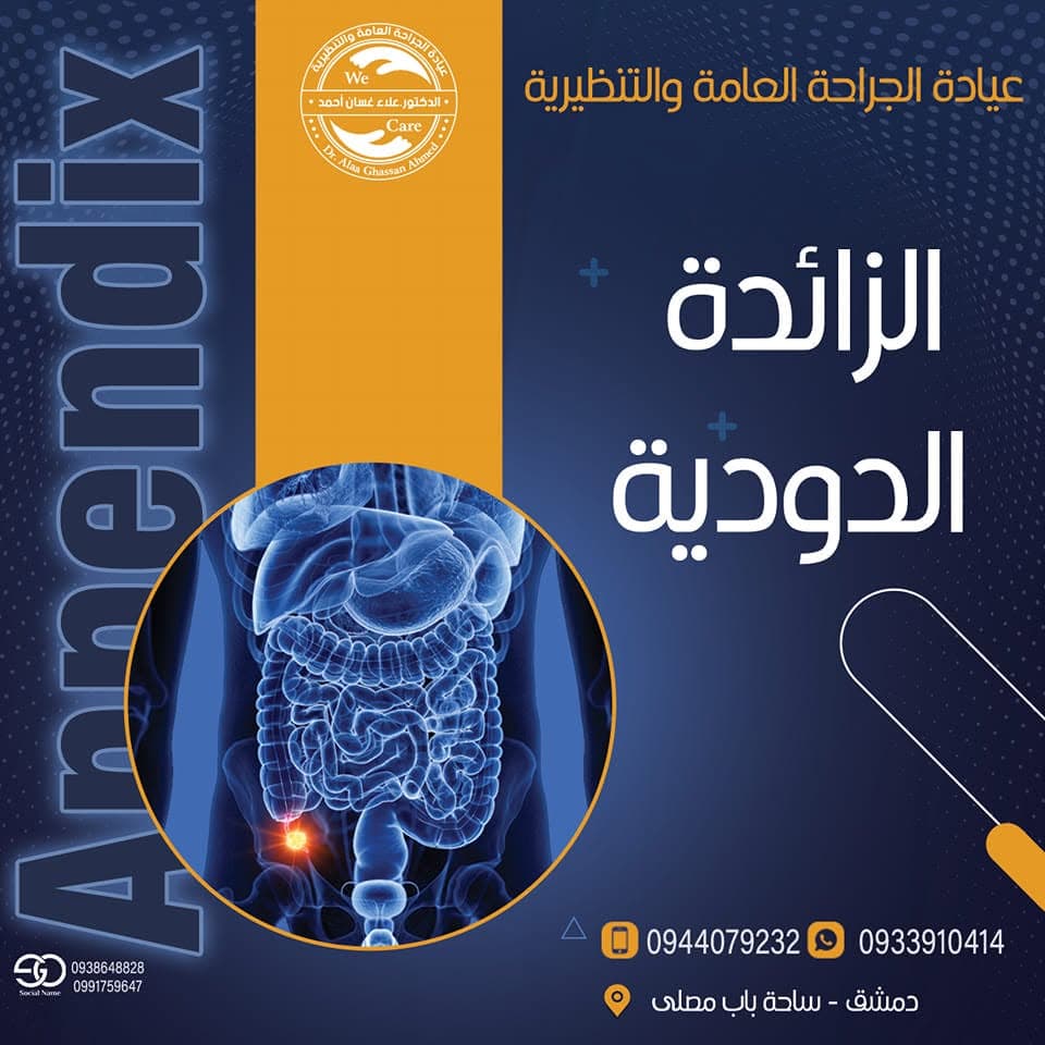 الزائدة الدودية